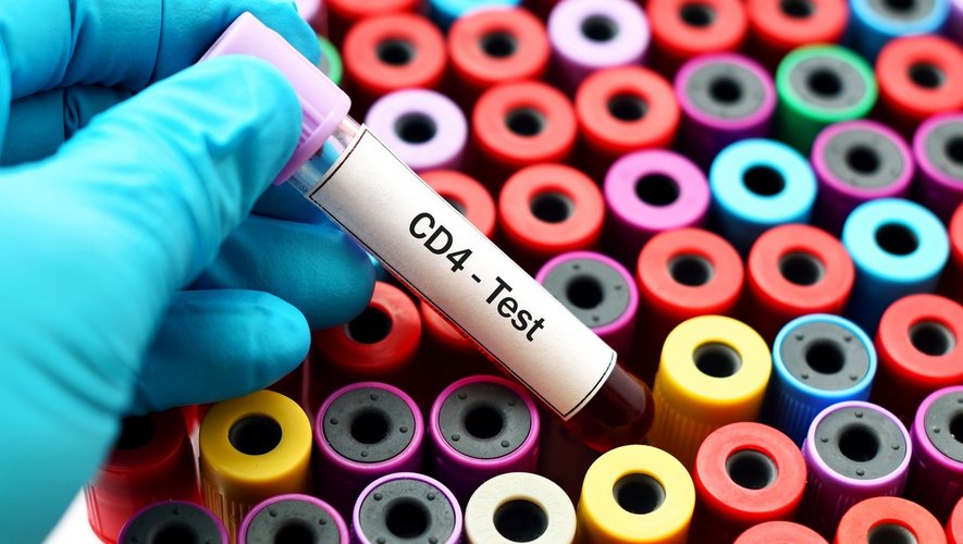 VIH/Sida : le taux de CD4, pour quoi faire ?