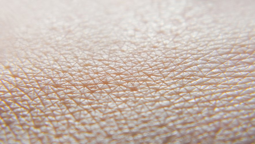 Les maladies de peau sont très répandues, mais un grand nombre de personnes ne consultent pas de spécialiste