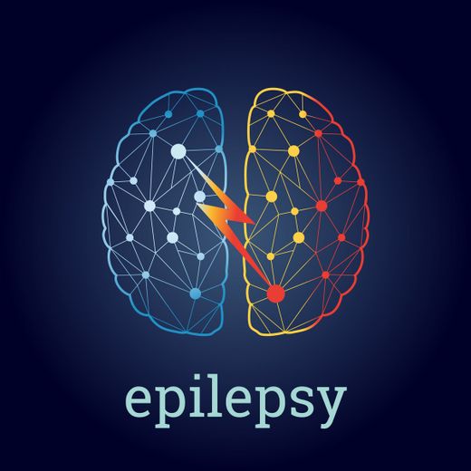 Epilepsie : comment fonctionne la neurostimulation ?