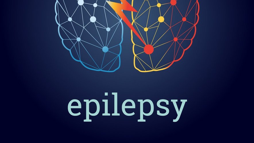 Epilepsie : comment fonctionne la neurostimulation ?