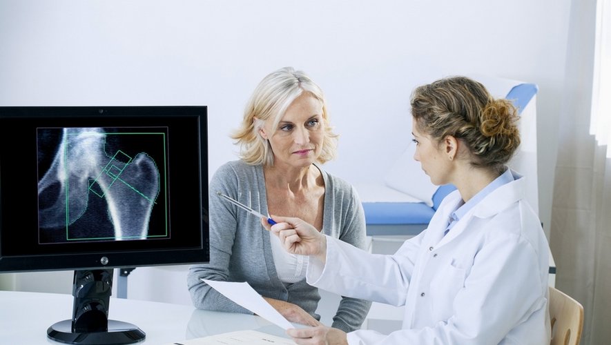 Ostéoporose : élargir les conditions du dépistage d’une maladie silencieuse