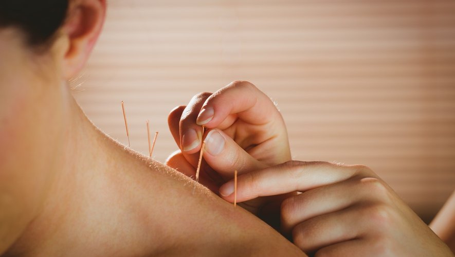L’acupuncture, précieuse technique contre la douleur