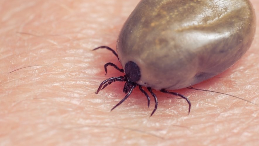 Maladie de Lyme : explosion des cas à venir au Royaume-Uni