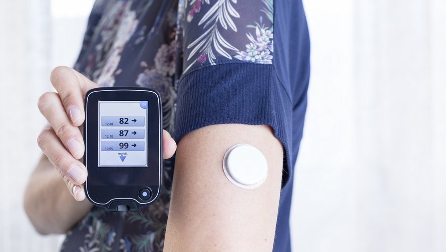 Diabète : quand l’auto-surveillance en continu profite aux patients