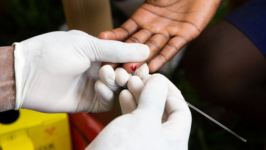 VIH: de moins en moins de nouveaux cas en France