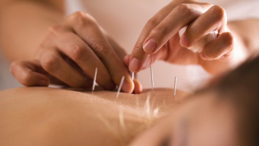 [vidéo] PMA : l’acupuncture pour favoriser les chances de grossesse