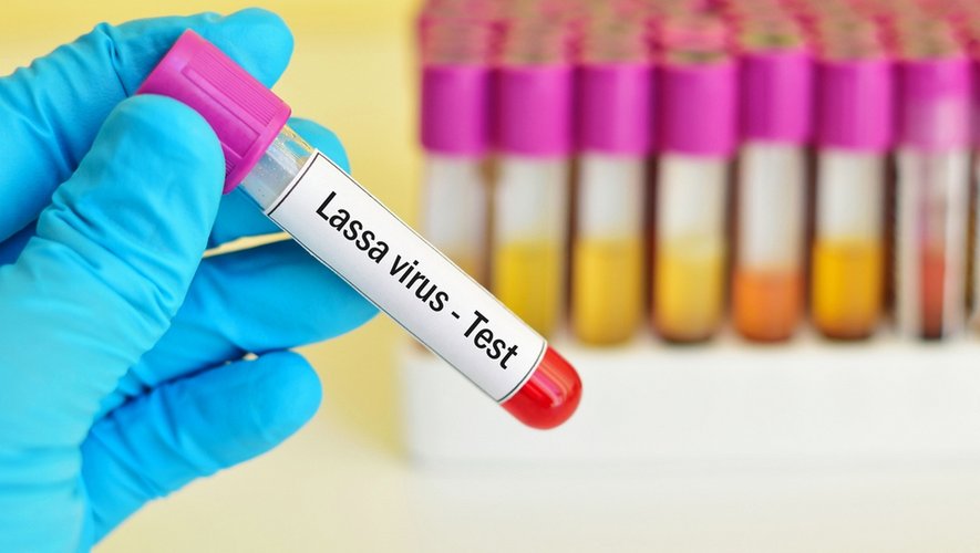 Bientôt un vaccin contre la fièvre de Lassa ?