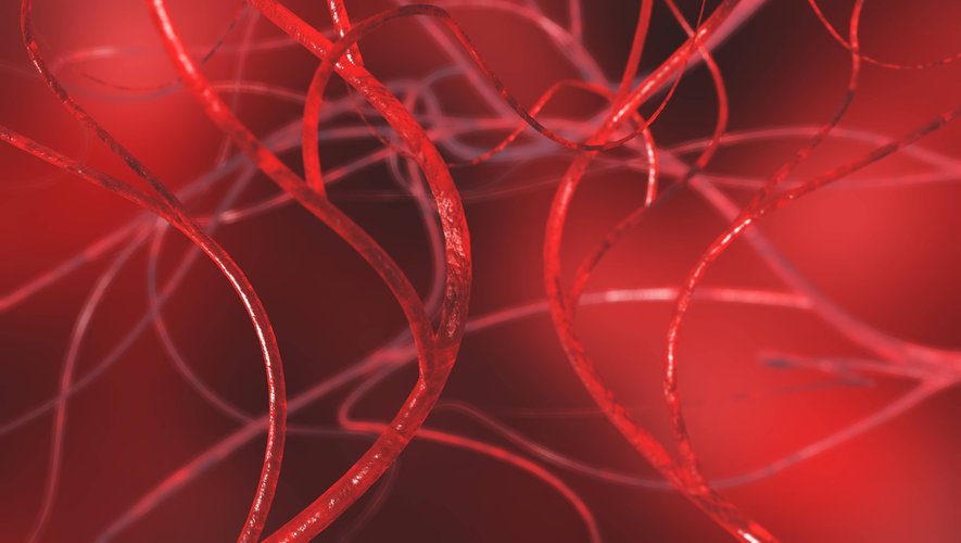 Des vaisseaux sanguins des femmes plus fragiles que ceux des hommes ?