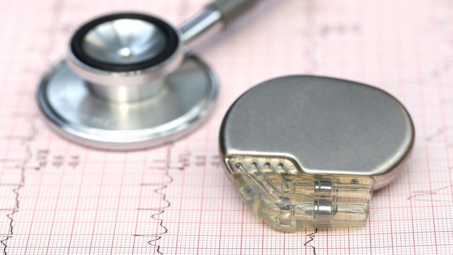 Un pacemaker pour prévenir les évanouissements ?