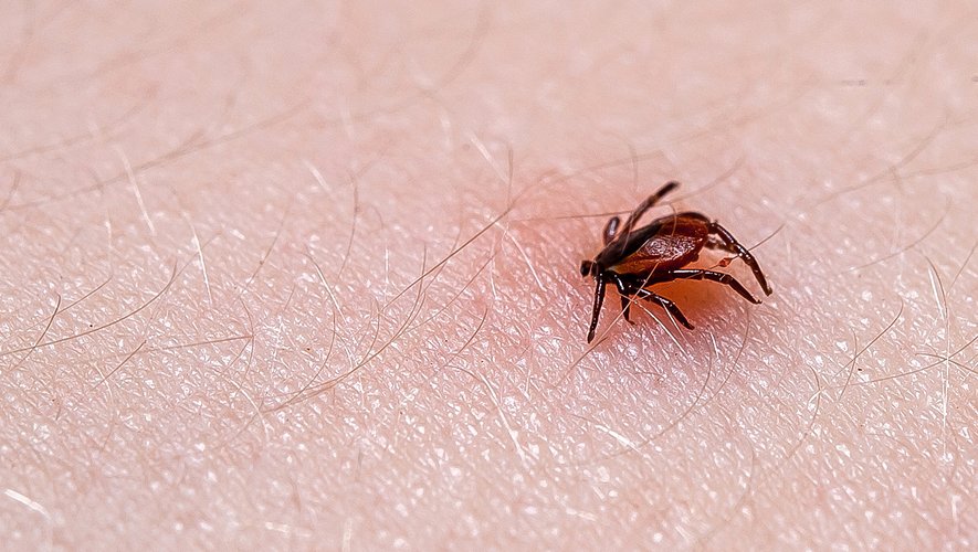 Le premier plan de lutte contre la maladie de Lyme, lancé en 2016, laisse un "bilan décevant".