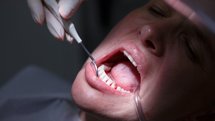 Comment prévenir la parodontite ?