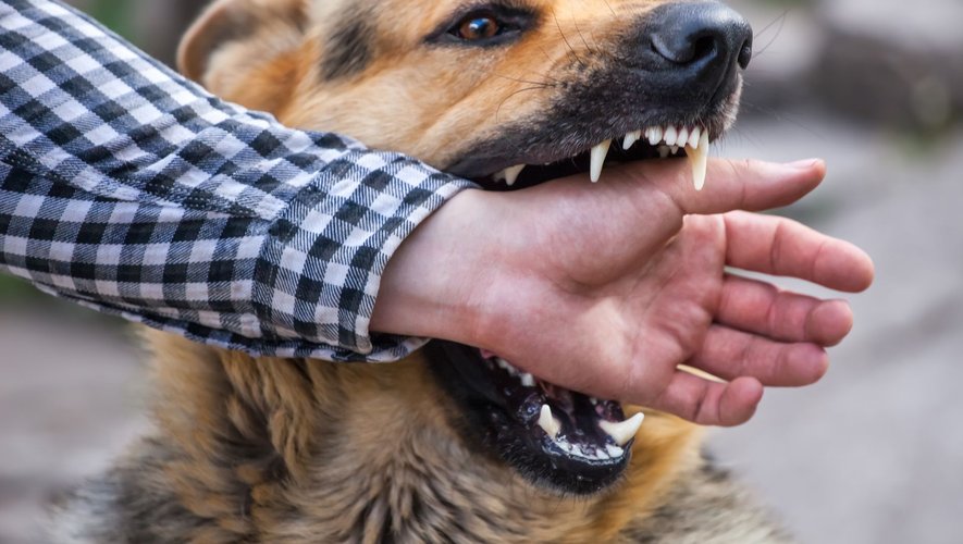 Comment réagir si votre chien a mordu ?