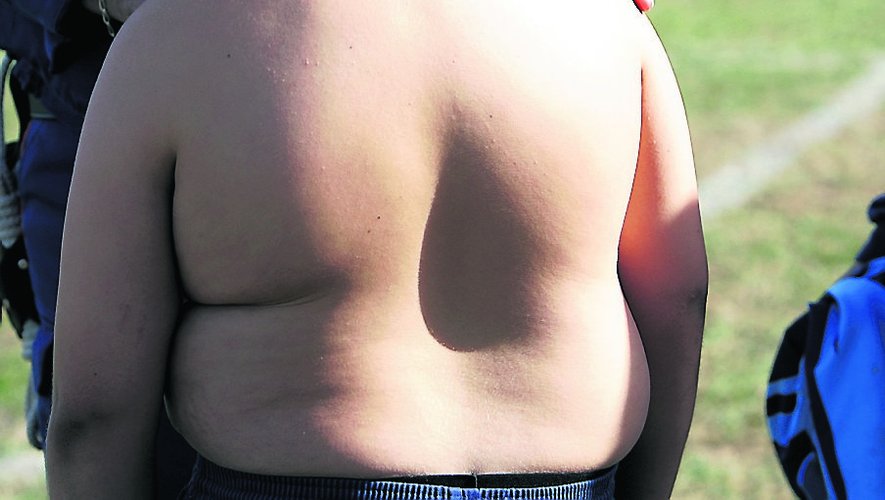 L’obésite et les problèmes de surpoids ne sont pas forcément dus à un excès de consommation de graisse./Photo archives
