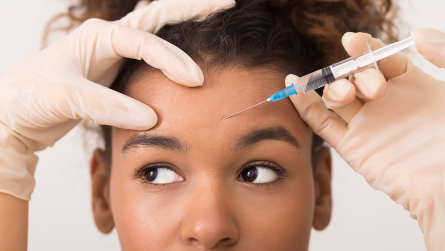 Le Botox induirait des complications chez une personne sur six, révèle une nouvelle étude.