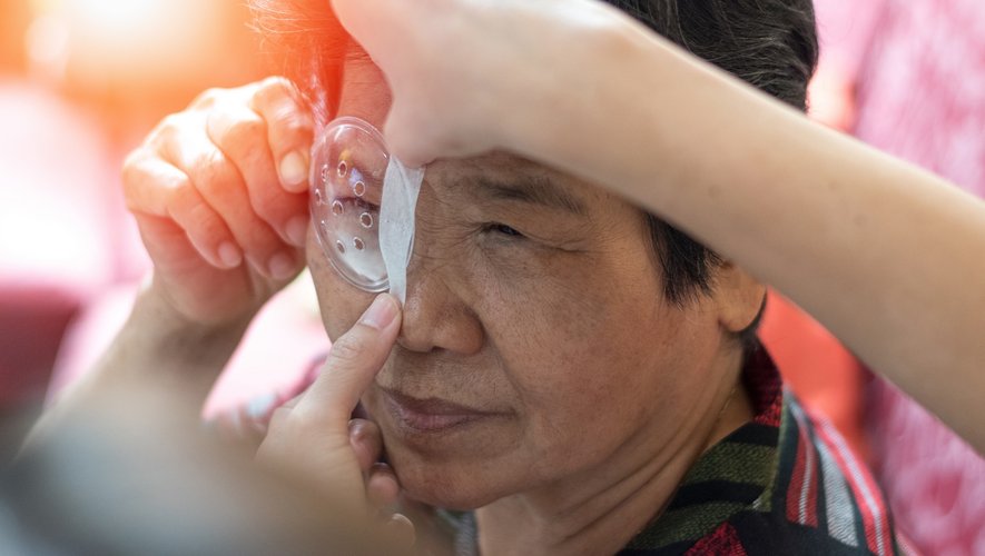 Opération de la cataracte : moins de risque de démence