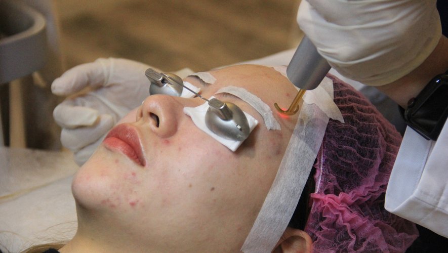 Kayla Zhang, une Shanghaïenne de 27 ans, vient de s'offrir un traitement laser, des injections et de se faire poser sous la peau du visage des fils tenseurs qui permettent de la "retendre" à la façon d'un lifting.