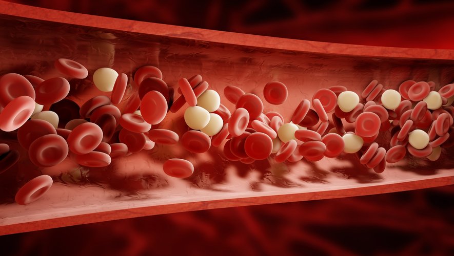 Le Covid-19 accroît le risque de développer des caillots sanguins graves jusque six mois après l'infection.
