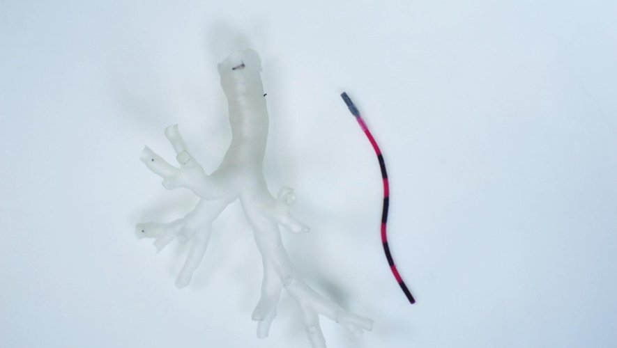 Ce robot miniature a pour le moment été expérimenté sur une réplique en 3D d'un arbre bronchique.
