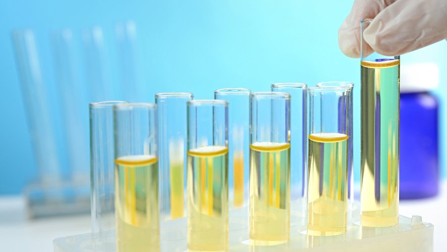 Notre urine, le nouvel engrais du futur ?