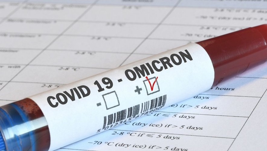 COVID-19: non abbiamo visto un tasso di infezione così basso nell’Aveyron dall’onda Omicron COVID-19: non abbiamo visto un tasso di infezione così basso nell’Aveyron dall’onda Omicron