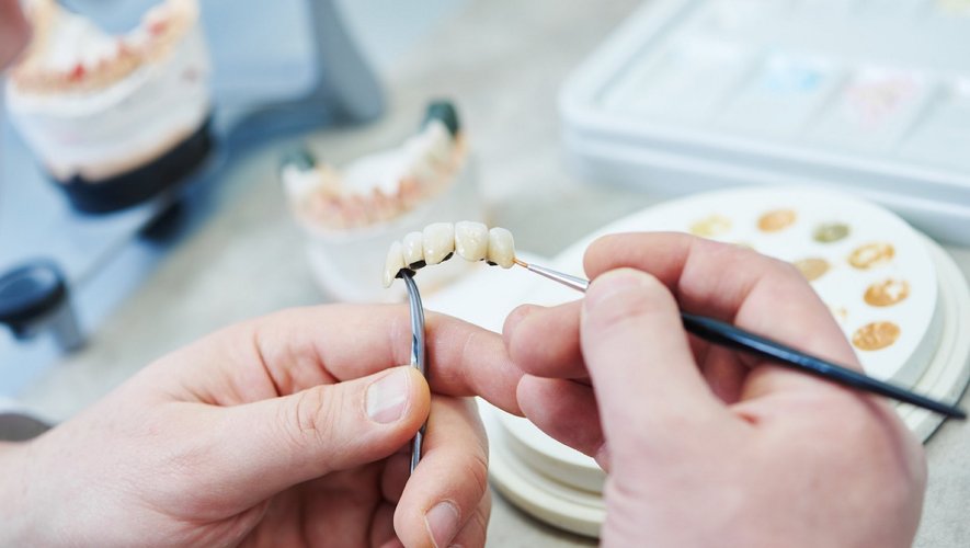 Qu’est-ce qu’un prothésiste dentaire ?