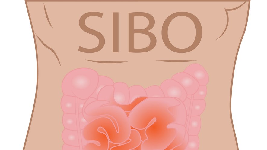 Le SIBO, un trouble méconnu