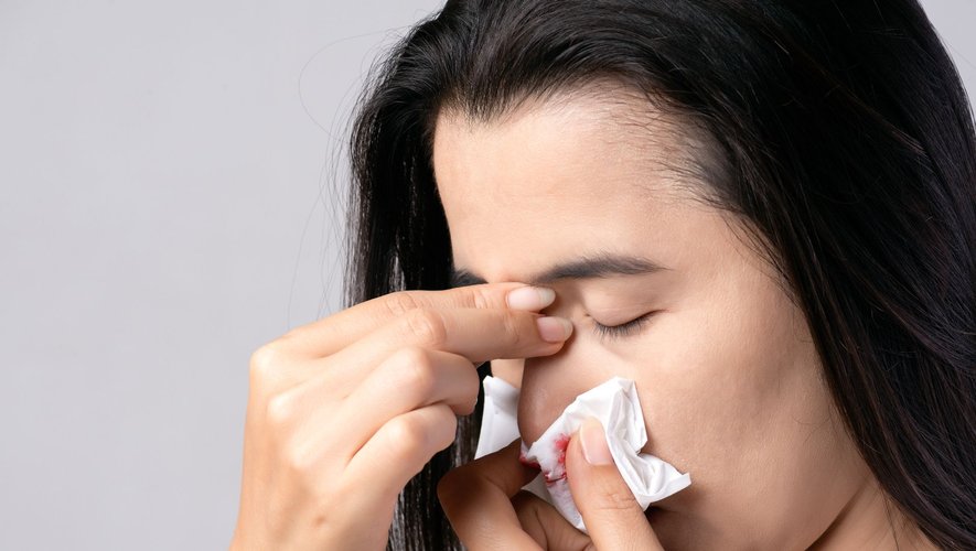 Pourquoi saigne-t-on du nez ?