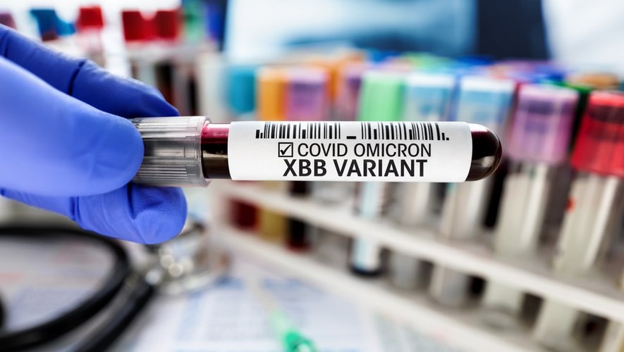 XBB 1.5, qui circule aux Etats-Unis, est le sous variant le plus transmissible et le plus résistant aux anticorps à ce jour. Il circule très faiblement en France. 