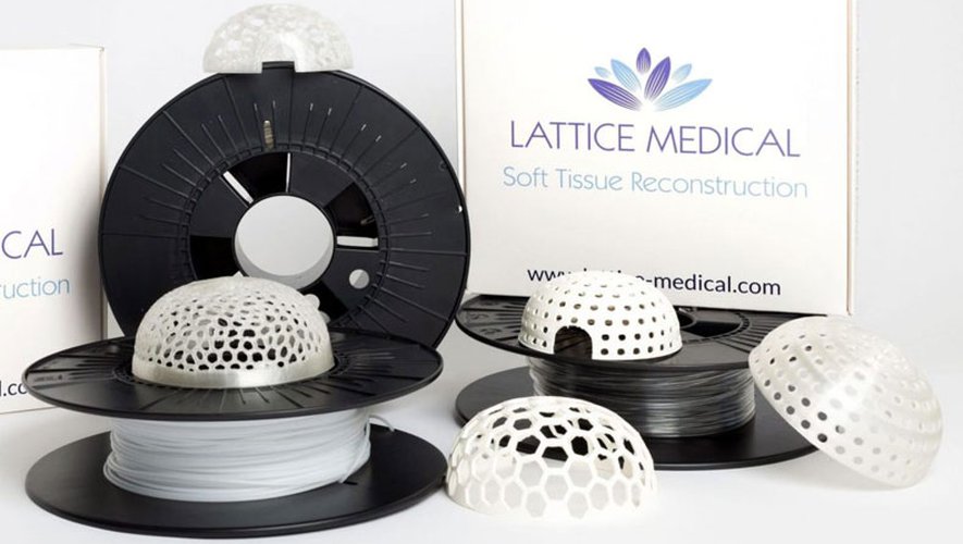 Lattice Medical met la 3D au service de la reconstruction mammaire 