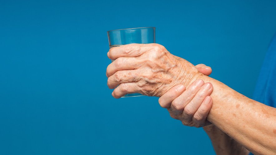 Maladie de Parkinson : reconnaître les principaux signes