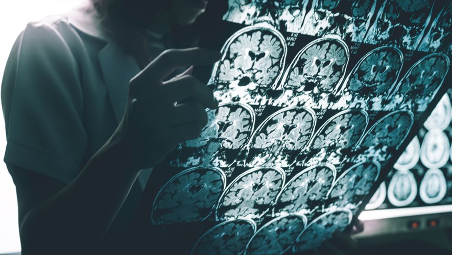 Maladie d’Alzheimer : deux études offrent l’espoir d’un traitement