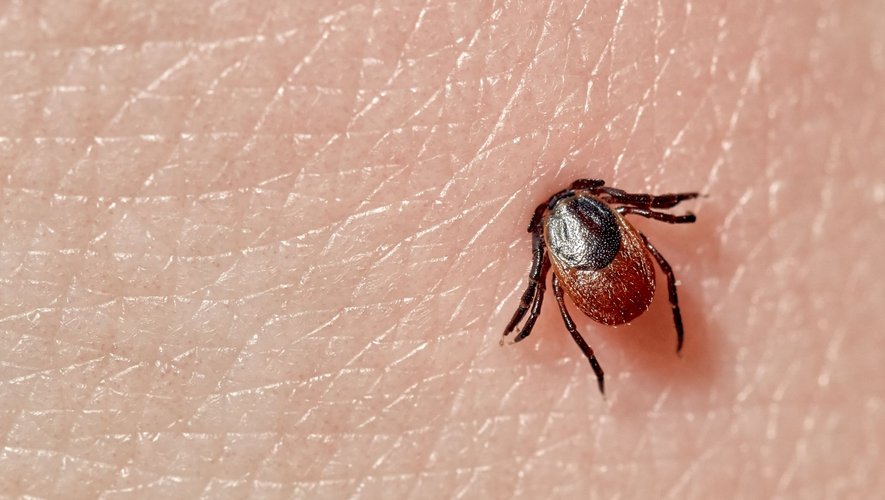 Maladie de Lyme : un vaccin qui empêche la transmission par la tique
