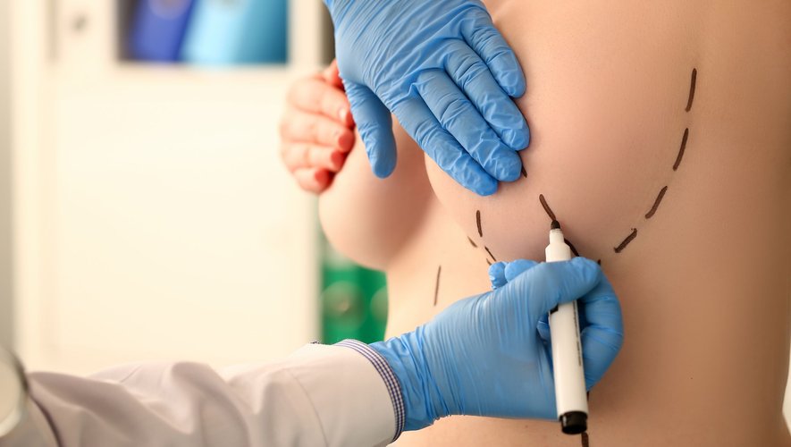 La réduction et le lifting mammaires pourraient compter parmi les procédures les plus prisées en 2024, d'après les professionnels de la chirurgie esthétique.