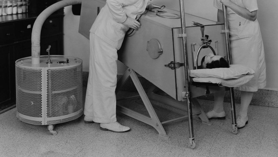 C’est quoi le "poumon d’acier" qui permettait de traiter la polio au milieu du XXe siècle ?
