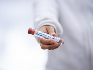 Covid-19 : pourquoi plus de quatre ans après le début de la pandémie, sa circulation est sur une pente ascendante en France