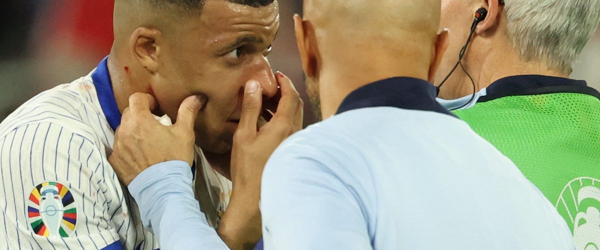 Euro 2024 : Ça va le faire, pas d’opération, durée des soins, confection d’un masque… Kylian Mbappé pourra-t-il jouer face aux Pays-Bas ?