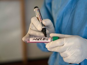 Épidémie de Mpox : 232 sites de vaccination ouverts en France, comment le monde prépare sa riposte