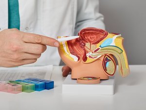 Cancer de la prostate : une expérimentation menée pour établir un diagnostic avec un simple test urinaire