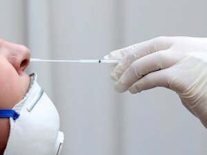 Deux cas de MERS-CoV identifiés en France : voici ce qu'il faut savoir sur ce virus contre lequel il n'existe aucun vaccin ni traitement