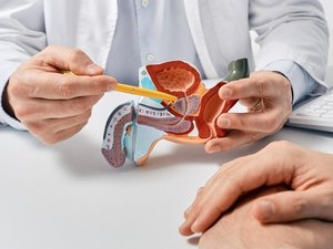 Cancer de la prostate : quel est ce traitement moins lourd désormais pris en charge par la Sécurité sociale ?