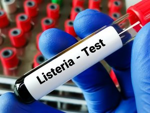 Ce qu'il faut savoir sur la listériose après les douze cas recensés ces derniers mois en France dont deux mortels