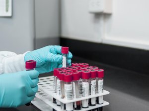 Cadmium : le dépistage des personnes exposées à ce métal lourd sera pris en charge à partir du 16 juin, qui pourra en bénéficier ?