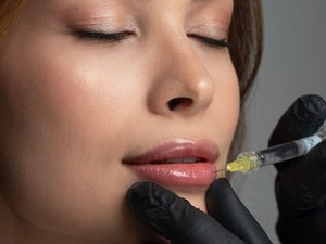 Elle donnait aux femmes des lèvres de bimbo, depuis 5 ans, sans diplôme ni hygiène et avec un produit interdit