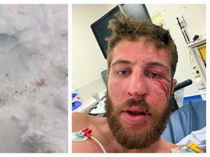 TÉMOIGNAGE. "Tout mon corps tremblait, j'étais frigorifié" : Maximilien était parti faire l'ascension du Mont-Blanc avec son frère, l'Aveyronnais chute sur le glacier et survit miraculeusement