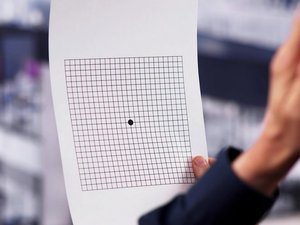 DMLA, principale cause de cécité dans le monde : comment fonctionne l'implant électronique désormais commercialisé en Europe ?